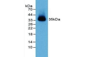 Detection of NECTIN2 in Mouse Heart Tissue using Polyclonal Antibody to Nectin 2 (NECTIN2) (PVRL2 antibody  (AA 83-291))