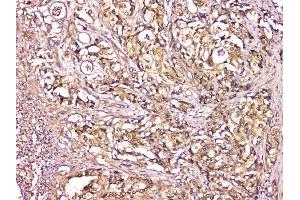 IHC analysis of CA2 using anti-CA2 antibody (ABIN6719533). (CA2 antibody  (AA 2-260))