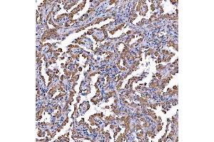 IHC analysis of TOMM34 using anti-TOMM34 antibody (ABIN7599253). (TOMM34 antibody  (AA 1-309))
