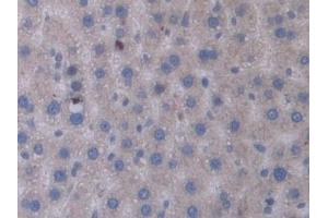 Detection of STAM1 in Rat Liver Tissue using Polyclonal Antibody to Signal Transducing Adaptor Molecule 1 (STAM1)