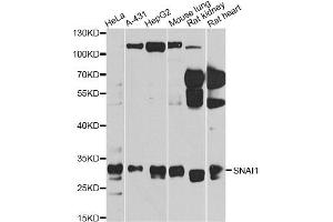 Western blot analysis of extracts of various cell lines, using SNAI1 antibody (ABIN5975364) at 1/1000 dilution. (SNAIL antibody)
