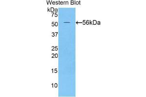 Western Blotting (WB) image for anti-Netrin 1 (NTN1) (AA 313-565) antibody (ABIN1860069) (Netrin 1 antibody  (AA 313-565))