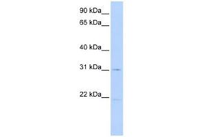 SLC25A21 antibody used at 1 ug/ml to detect target protein.