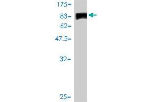 Western Blot detection against Immunogen (107. (JUP antibody  (AA 1-745))