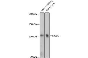 Western blot analysis of extracts of various cell lines, using NOD2 Rabbit pAb (ABIN7269065) at 1:1000 dilution. (NOD2 antibody  (AA 611-910))