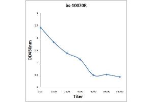 Antigen: 2 µg/100 µL  Primary: Antiserum, 1:500, 1:1000, 1:2000, 1:4000, 1:8000, 1:16000, 1:32000;  Secondary: HRP conjugated Rabbit Anti-Goat IgG at 1: 5000;  TMB staining Read the data in Microplate Reader by 450nm. (IL-31 antibody  (AA 21-120))