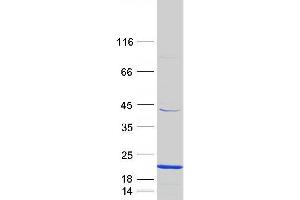 Validation with Western Blot