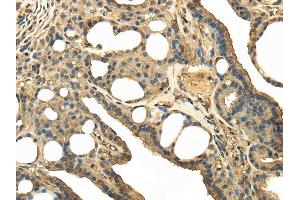 Immunohistochemistry (IHC) image for anti-Transient Receptor Potential Cation Channel, Subfamily C, Member 4 Associated Protein (TRPC4AP) antibody (ABIN5957757) (TRPC4AP antibody)