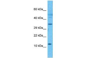 Western Blotting (WB) image for anti-RP3-473B4.1 (N-Term) antibody (ABIN2785035) (RP3-473B4.1 (N-Term) antibody)