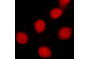 ABIN6269055 staining MCF-7 cells by ICC/IF. (Survivin antibody  (Internal Region))