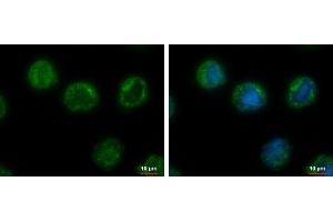 ICC/IF Image CHMP5 antibody [N1C3] detects CHMP5 protein at cytoplasm by immunofluorescent analysis. (CHMP5 antibody)