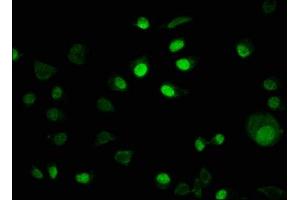Immunofluorescence staining of MCF-7 cells with ABIN7157075 at 1:100, counter-stained with DAPI. (IRX4 antibody  (AA 287-363))