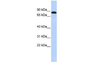 WB Suggested Anti-DSC3 Antibody Titration:  0. (Desmocollin 3 antibody  (N-Term))