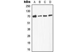 Western blot analysis of TGFBR2 (pS225) expression in A549 (A), NIH3T3L1 (B), KNRK (C), HepG2 (D) whole cell lysates. (TGFBR2 antibody  (pSer225))