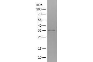 Western Blotting (WB) image for Glutaminase (GLS) (AA 609-669) protein (His-IF2DI Tag) (ABIN7123119) (Glutaminase Protein (GLS) (AA 609-669) (His-IF2DI Tag))