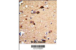 Formalin-fixed and paraffin-embedded human brain tissue with UNC5C Antibody , which was peroxidase-conjugated to the secondary antibody, followed by DAB staining. (Unc5c antibody  (AA 188-217))