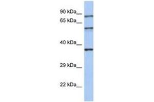 Image no. 1 for anti-Rabphilin 3A (RPH3A) (AA 35-84) antibody (ABIN6744373) (RPH3A antibody  (AA 35-84))