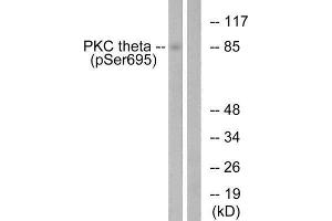 Western Blotting (WB) image for anti-Protein Kinase C, theta (PRKCQ) (pSer695) antibody (ABIN1847342)