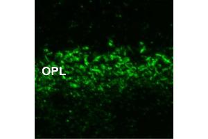 Indirect immunostaining of ribbon synapses in the outer plexiform layer of unfixed mouse retina (dilution 1 : 500). (Regulating Synaptic Membrane Exocytosis 1 (RIMS1) (AA 207-366) antibody)