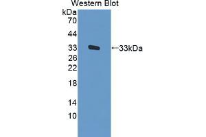 Western blot analysis of the recombinant protein. (FES antibody  (AA 509-766))