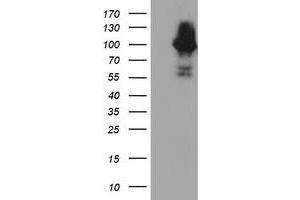 Western Blotting (WB) image for anti-Complement Component 1, S Subcomponent (C1S) antibody (ABIN1497565) (C1S antibody)