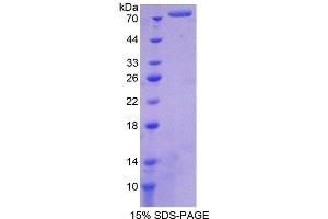 SDS-PAGE (SDS) image for Heat Shock Protein 90kDa alpha (Cytosolic), Class A Member 1 (HSP90AA1) (AA 1-496), (AA 698-732) protein (His tag) (ABIN1079830)