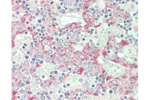 Human Liver: Formalin-Fixed, Paraffin-Embedded (FFPE).