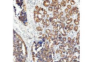 IHC analysis of ECE1 using anti-ECE1 antibody (ABIN5518828). (ECE1 antibody  (AA 18-233))
