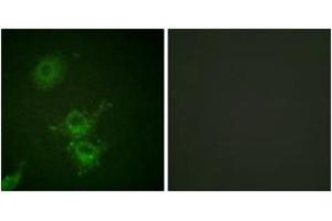 Immunofluorescence analysis of HuvEc cells, using EGFR (Phospho-Thr693) Antibody.