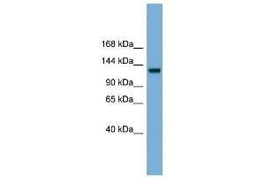 RASGRF1 antibody used at 0. (RASGRF1 antibody  (Middle Region))