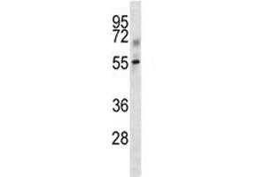 Tgfbr1 antibody western blot analysis in mouse kidney tissue lysate. (TGFBR1 antibody  (AA 141-169))