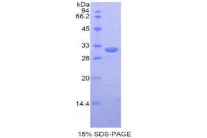 SDS-PAGE (SDS) image for Protein Disulfide Isomerase Family A, Member 3 (PDIA3) (AA 162-416) protein (His tag) (ABIN2121955)