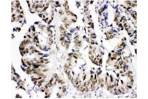 IHC analysis of KDM5B using anti-KDM5B antibody (ABIN4886648). (KDM5B antibody  (Middle Region))