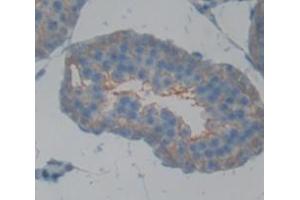 Figure. (CD40 antibody  (AA 24-193))