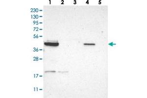 Western blot analysis of Lane 1: RT-4, Lane 2: U-251 MG, Lane 3: Human Plasma, Lane 4: Liver, Lane 5: Tonsil with GRAMD3 polyclonal antibody  at 1:250-1:500 dilution.