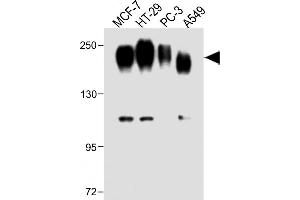 All lanes : Anti-CEA Antibody (Center) at 1:1000 dilution Lane 1: MCF-7 whole cell lysate Lane 2: HT-29 whole cell lysate Lane 3: PC-3 whole cell lysate Lane 4: A549 whole cell lysate Lysates/proteins at 20 μg per lane.
