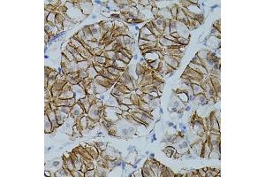 Immunohistochemistry of paraffin-embedded human stomach using CLDN3 antibody (ABIN3017039, ABIN3017040, ABIN3017041, ABIN1679261 and ABIN6219930) (40x lens). (Claudin 3 antibody)