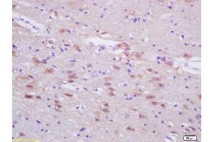 Formalin-fixed and paraffin embedded rat brain labeled with Anti-ASN/Fatty Acid Synthase 1 Polyclonal Antibody, Unconjugated (ABIN687382) at 1:200, followed by conjugation to the secondary antibody and DAB staining