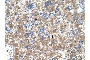 PEX3 antibody was used for immunohistochemistry at a concentration of 4-8 ug/ml to stain Hepatocytes (arrows) in Human Liver. (PEX3 antibody  (N-Term))