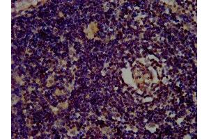 IHC image of ABIN7153444 diluted at 1:400 and staining in paraffin-embedded human lymph node tissue performed on a Leica BondTM system. (Galectin 10 antibody  (AA 2-142))