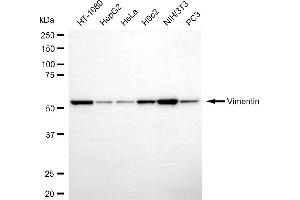 Western blotting analysis using vimentin antibody (ABIN7800836).