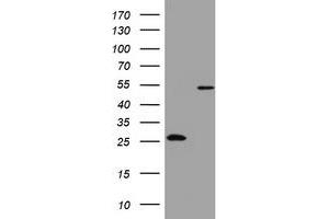 Image no. 4 for anti-3-Oxoacyl-ACP Synthase, Mitochondrial (OXSM) (AA 78-343) antibody (ABIN1491674) (OXSM antibody  (AA 78-343))