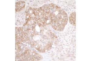 anti-Echinoderm Microtubule Associated Protein Like 4 (EML4) (AA 150-200) antibody