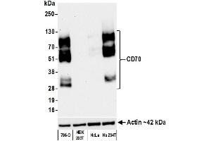 Western Blotting (WB) image for anti-CD70 Molecule (CD70) (AA 50-193) antibody (ABIN7449156)