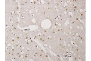 Image no. 1 for anti-TP53 Regulating Kinase (TP53RK) (AA 154-253) antibody (ABIN466264) (TP53RK antibody  (AA 154-253))