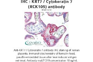 Image no. 1 for anti-Keratin 7 (KRT7) antibody (ABIN1724125) (Cytokeratin 7 antibody)