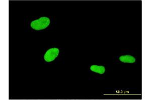 Immunofluorescence of monoclonal antibody to ZKSCAN4 on HeLa cell. (ZKSCAN4 antibody  (AA 1-545))