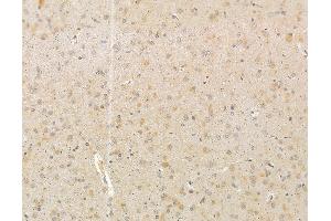 ABIN6265291 and ABIN6279800 at 1/100 staining rat brain tissue by IHC-P. (SRPK2 antibody  (Internal Region))