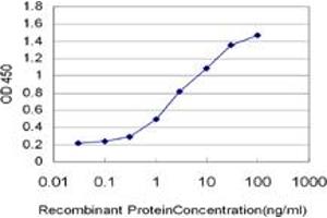Detection limit for recombinant GST tagged IRF2 is approximately 0. (IRF2 antibody  (AA 216-315))