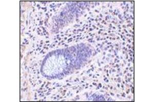 Immunohistochemistry of Lano in human colon tissue with this product at 10 μg/ml. (LRRC1 antibody  (C-Term))